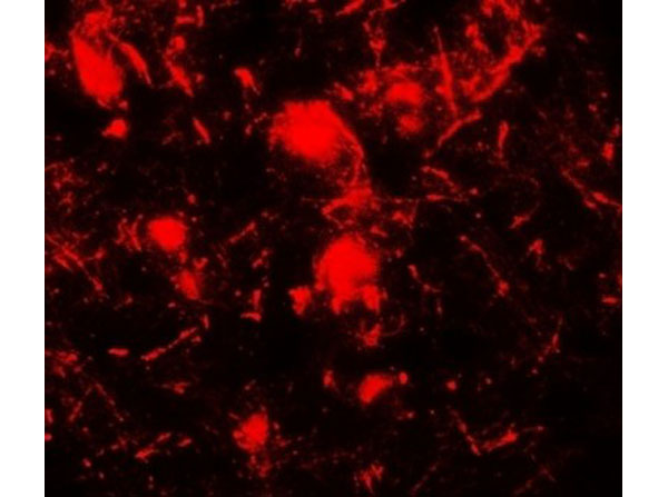 Immunofluorescence of ULK2