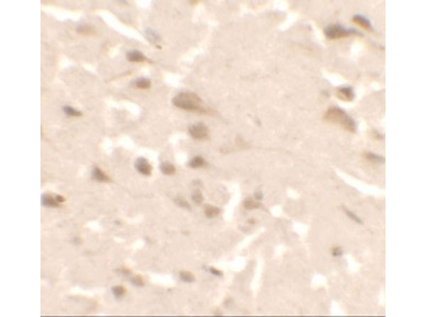 Immunohistochemistry of ULK2