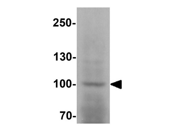 Western blot of ULK2