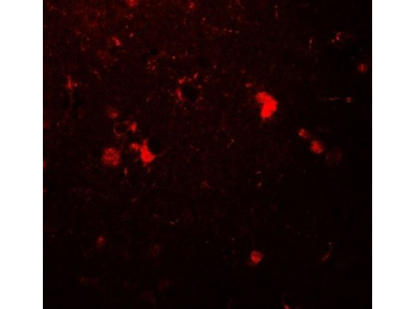 Immunofluorescence of ULK3