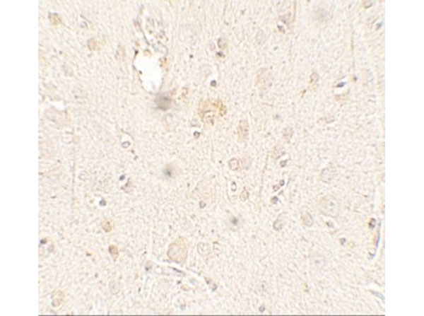 Immunohistochemistry of ULK3