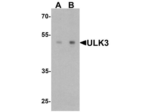 Western blot of ULK3