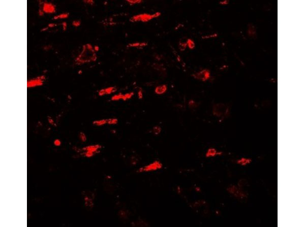 Immunofluorescence of ULK4