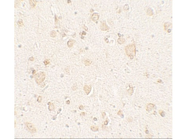 Immunohistochemistry of ULK4