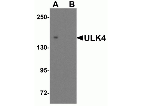 Western blot of ULK4