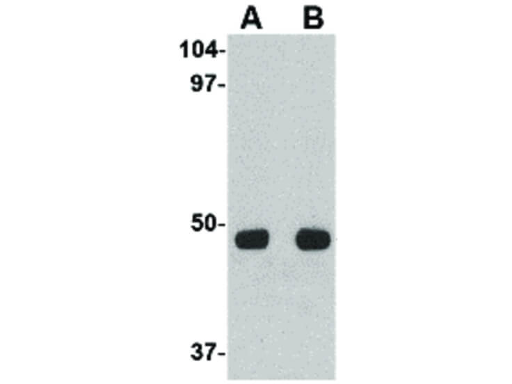 Western Blot of Unc93a Antibody
