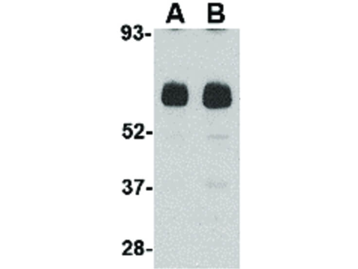 Western Blot of Unc93b Antibody