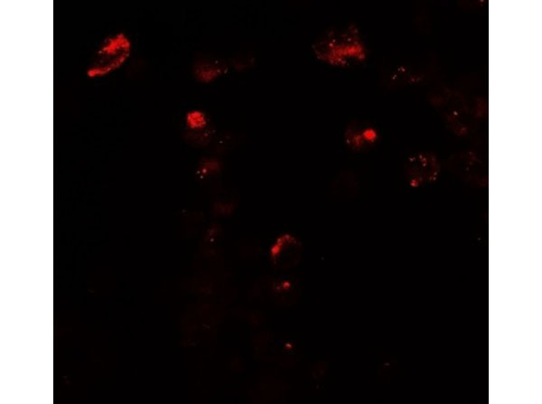 Immunofluorescence of UNG2