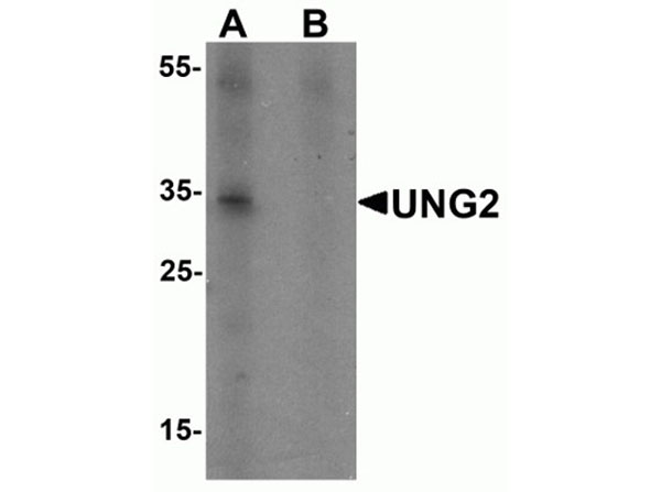 Western blot of UNG2