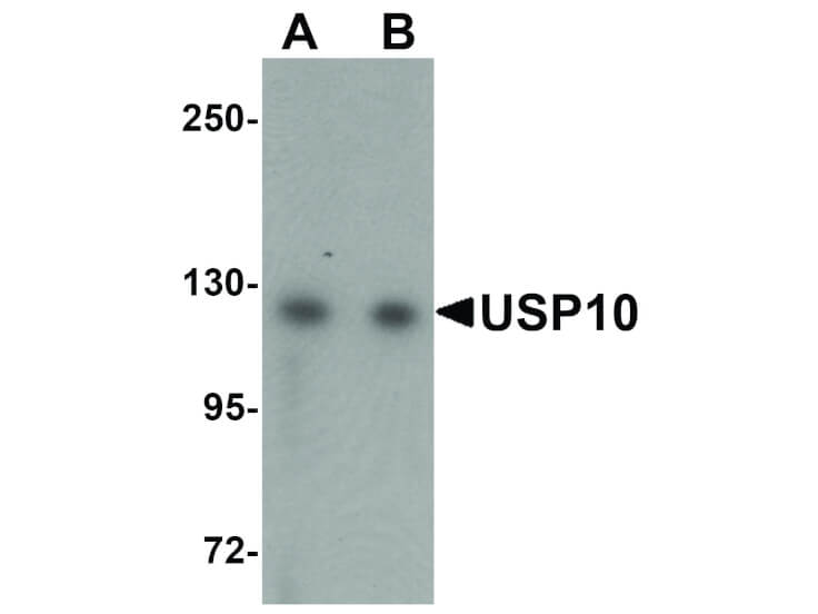 Western Blot of USP10 Antibody