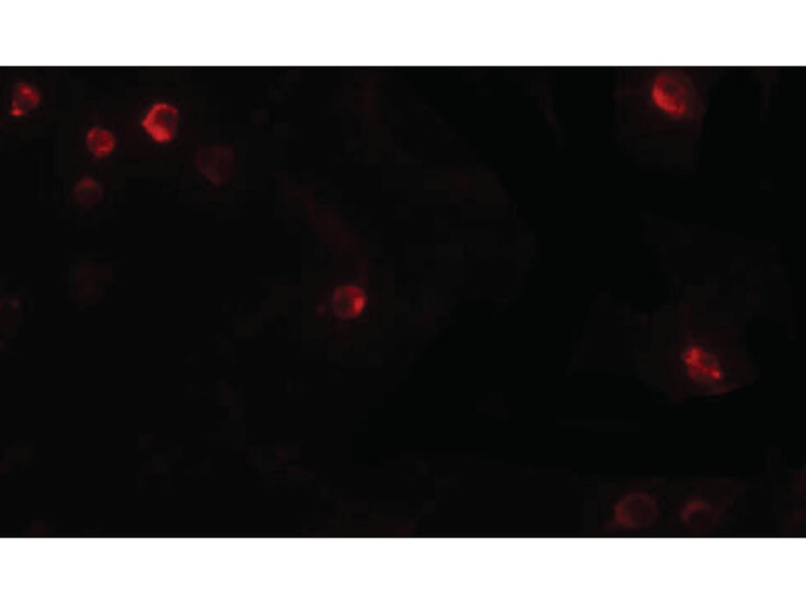 Immunofluorescence of USP10 Antibody