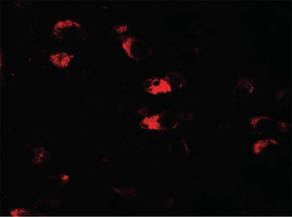 Immunofluorescence of USP25 Antibody