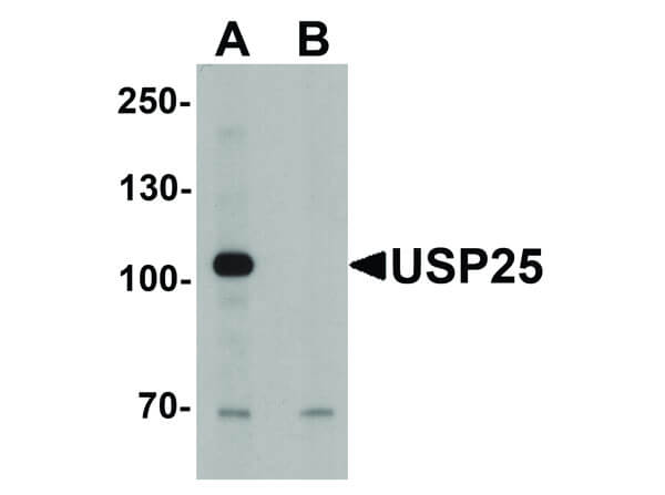 Western Blot of USP25 Antibody
