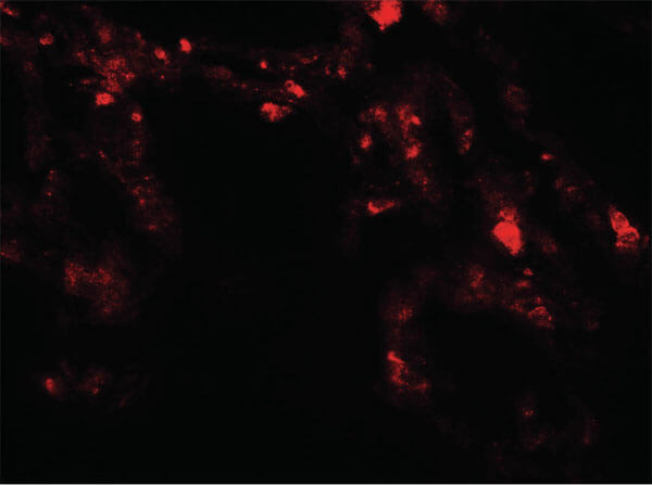 Immunofluorescence of UVRAG Antibody