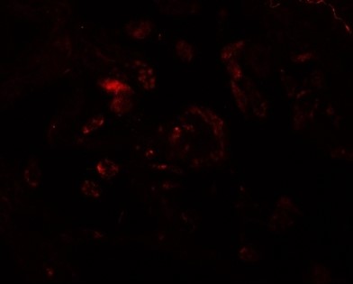 Immunofluorescence of VAMP7