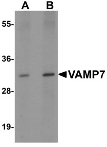 Western blot analysis of VAMP7.