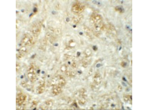 Immunohistochemistry of VASH1