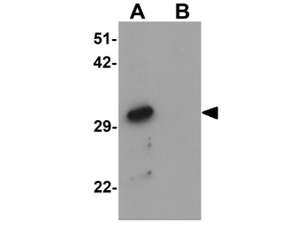 Western blot analysis of VASH1.