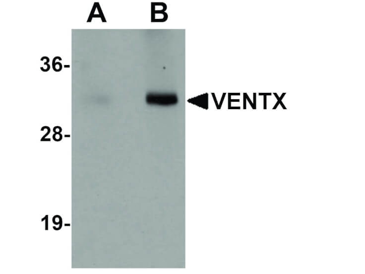 Western Blot of VENTX Antibody
