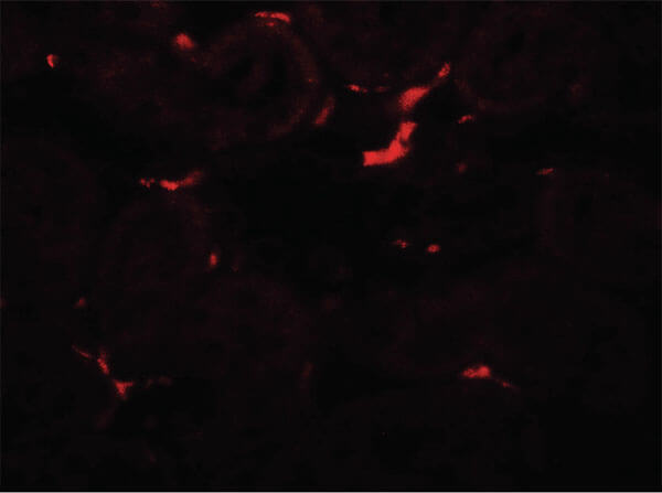 Immunofluorescence of VEZT Antibody
