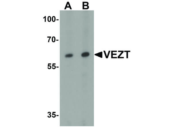 Western Blot of VEZT Antibody