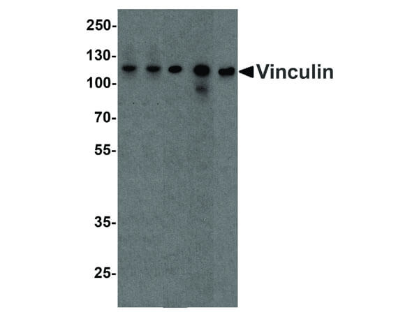 Western Blot of Vinculin Antibody