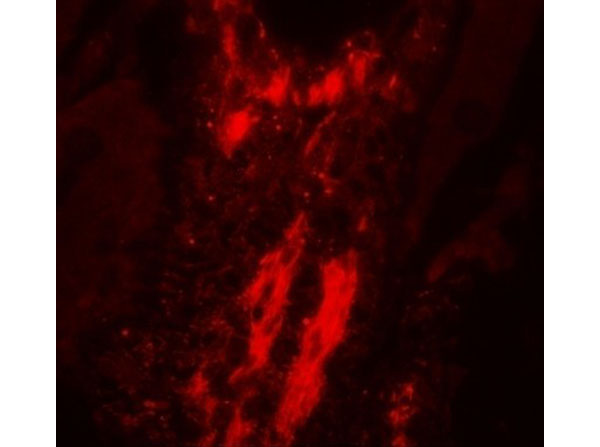 Immunofluorescence of Vinculin