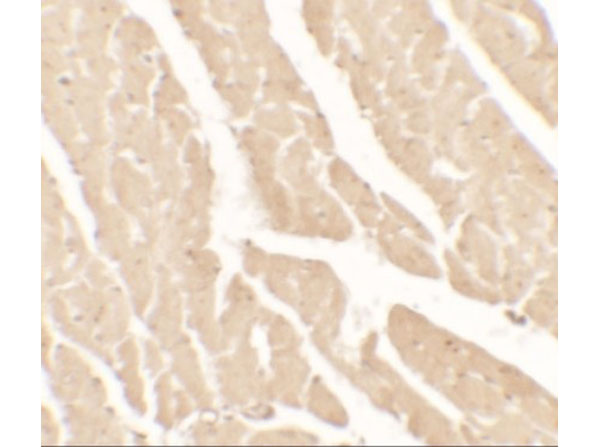 Immunohistochemistry of Vinculin