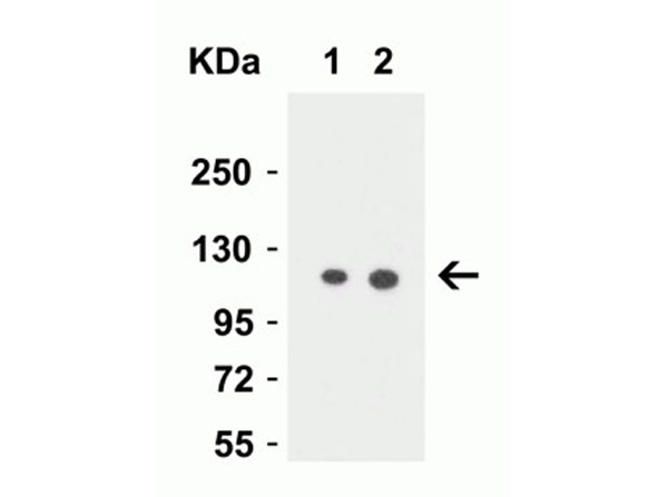 Western Blot of Vinculin