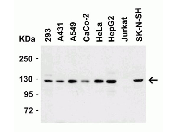 Western Blot of Vinculin