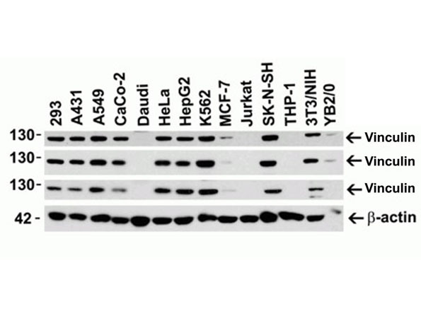 Western Blot of Vinculin