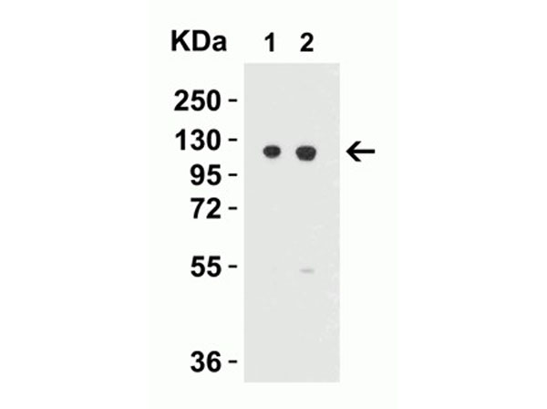 Western Blot of Vinculin