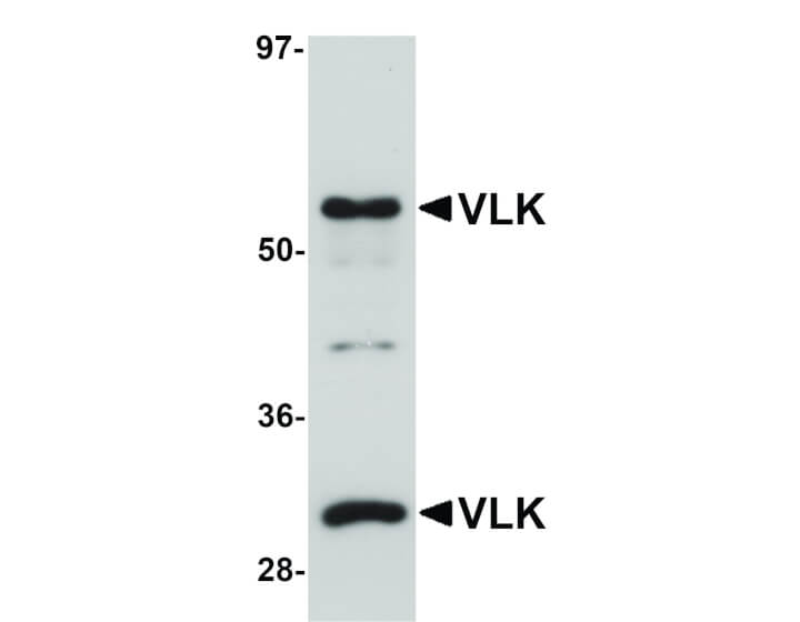 Western Blot of VLK Antibody