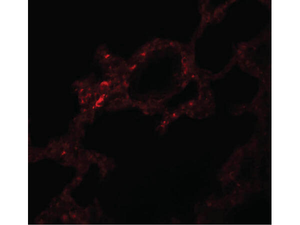 Immunofluorescence of VLK Antibody