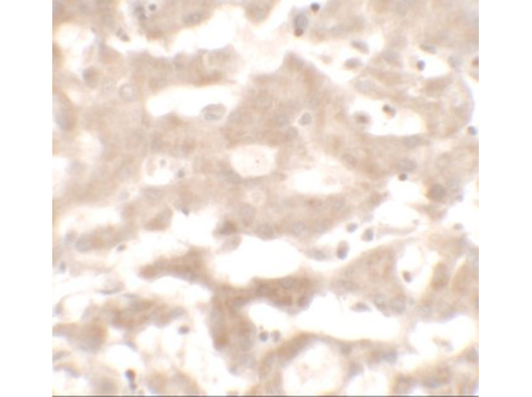 Immunohistochemistry of VNN3