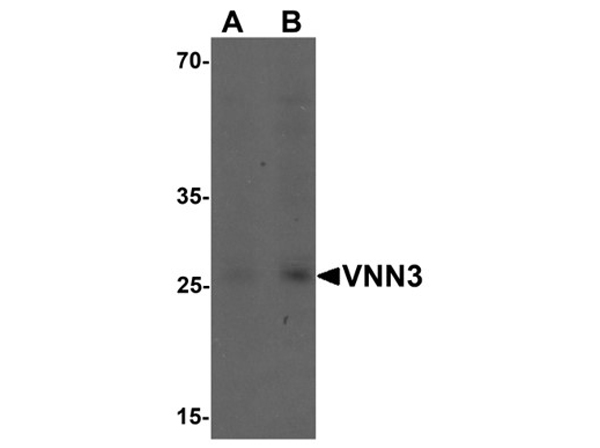 Western blot analysis of VNN3