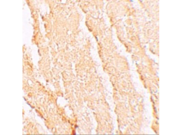 Immunohistochemistry of VPS39