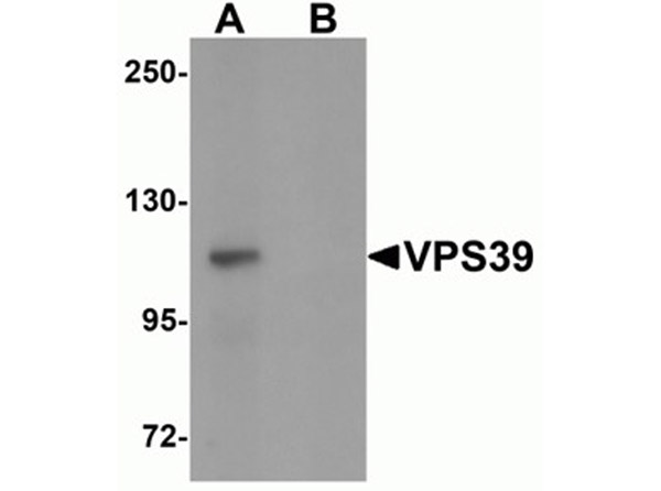 Western blot analysis of VPS39