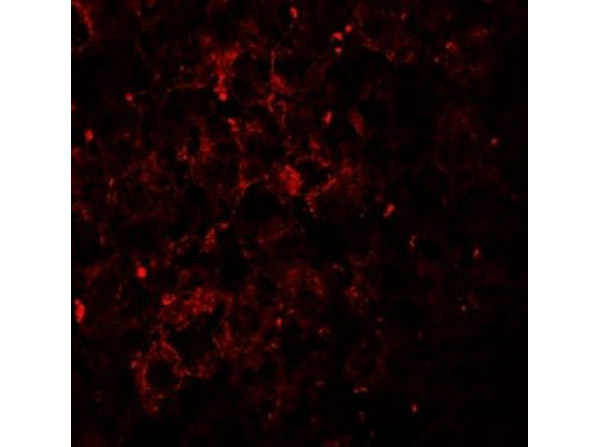 Immunofluorescence of VPS39