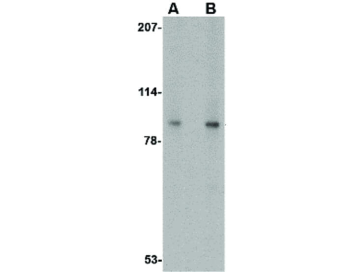 Western Blot of VPS53 Antibody