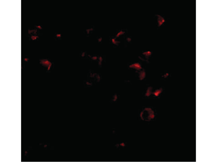 Immunofluorescence of VPS53 Antibody