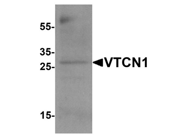 Western blot analysis of VTCN1