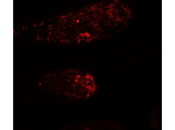 Immunofluorescence of WAC