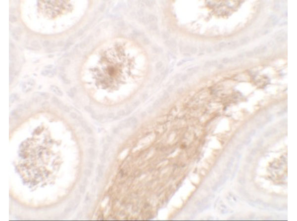 Immunohistochemistry of WAC