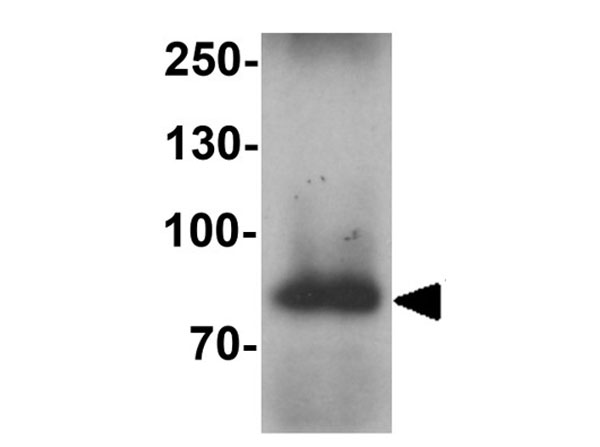 Western blot analysis of WAC