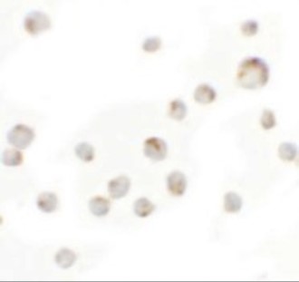 Immunocytochemistry of WDR5