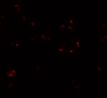 Immunofluorescence of WDR5