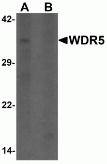 Western blot analysis of WDR5