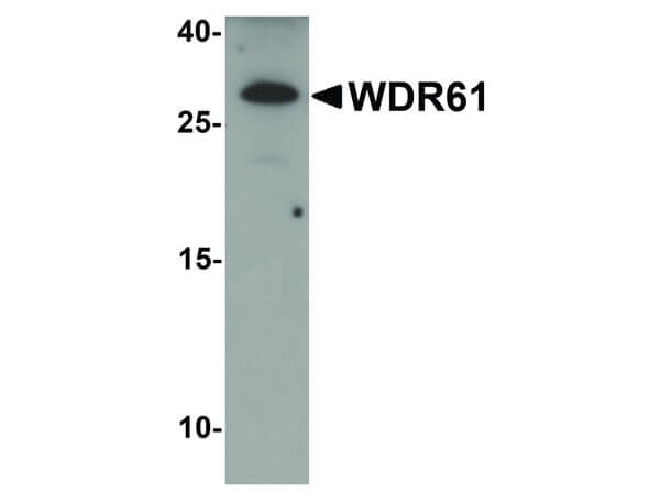 Western Blot of WDR61 Antibody