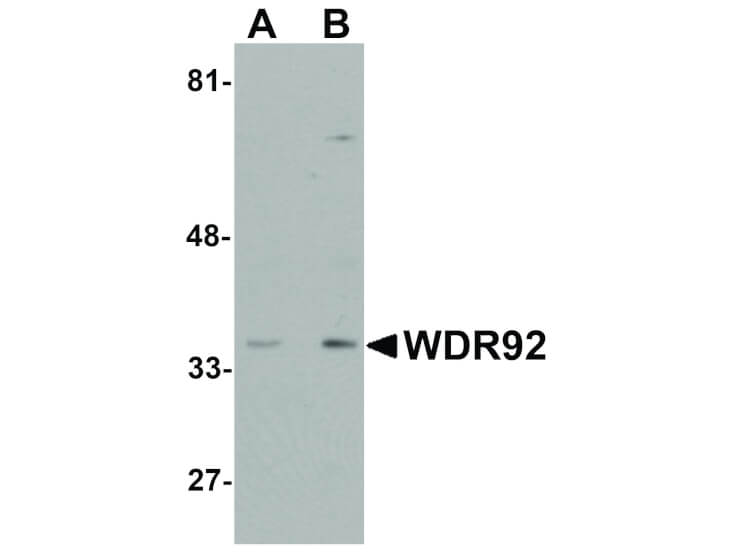 Western Blot of WDR92 Antibody